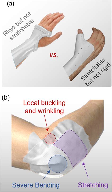 (a). Bandages that typically combine different types of large ...