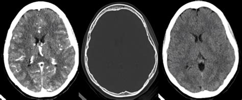 Head CT typical scans. Left to right: Head CT with contrast, Head CT ...