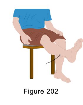 Torn Meniscus Exercises - Sinew Therapeutics