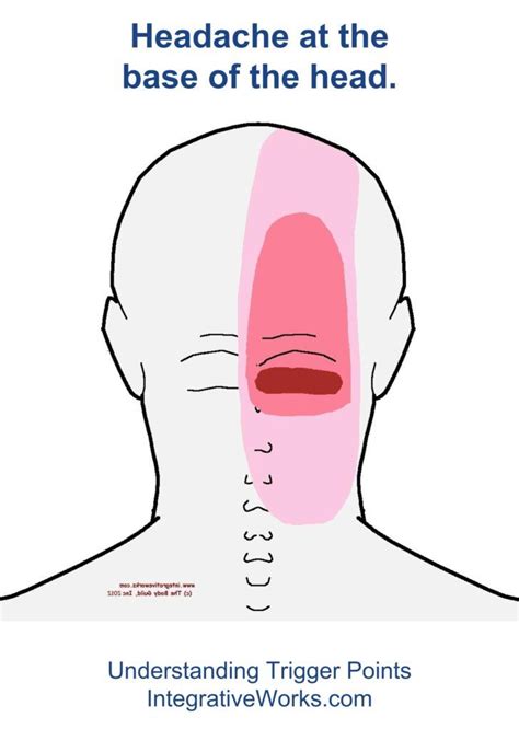 Neck Pain Base Of Head