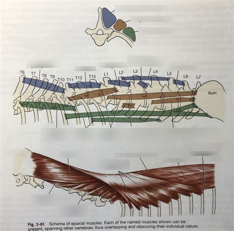 Epaxial muscles Diagram | Quizlet