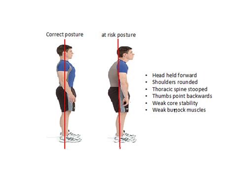 Shoulder Impingement/Bursitis