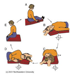 Epley Maneuver - Exercises for Vertigo - ENT Clinic