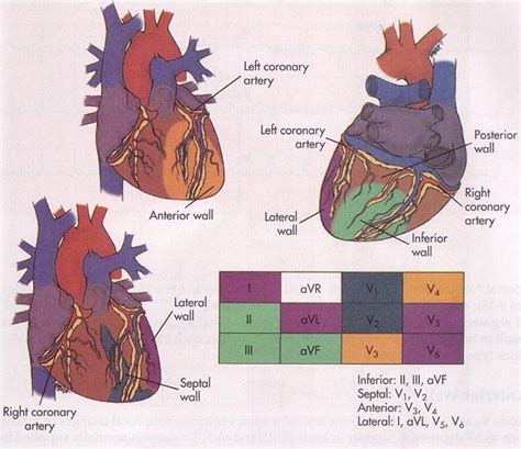 17 Best images about Nursing - Cardiac on Pinterest | Heart disease ...