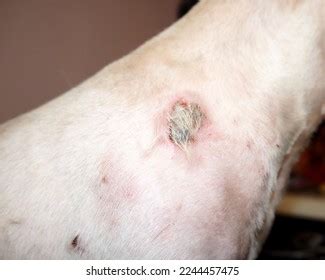 Flea Allergy Dermatitis On Humans