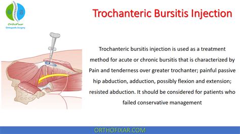 Orthopedic Procedures In Orthopedic Surgery From A To Z