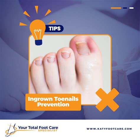 Ingrown Toenails Prevention Tips