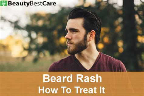 Beard Rash ? What is It & How To Treat It | BeautyBestCare