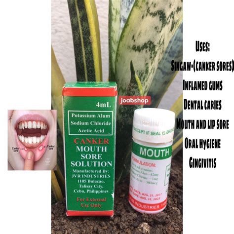 Canker mouth sore solution 4ml/singaw treatment | Shopee Philippines