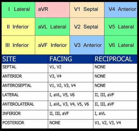 12 Lead Ekg Interpretation Cheat Sheet | Cheat Sheet