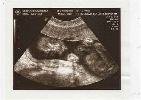 Texas Schleichers: Baby Ultrasound & Gender Reveal!