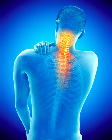 Symptoms and Treatments of Facet Arthropathy