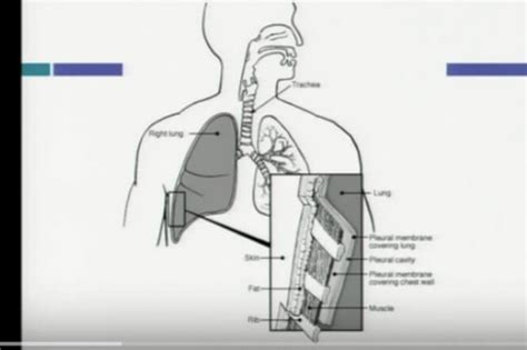 Cancer In Lymph Nodes In Neck