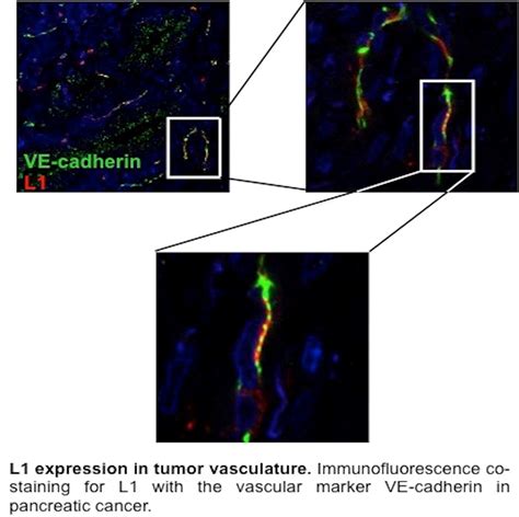 Tumor immunology