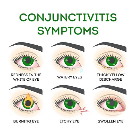 Pink Eye (Conjunctivitis): Causes, Symptoms & Treatments