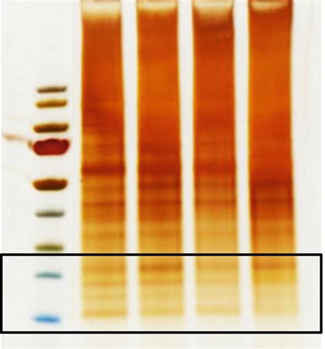 Gel analysis. The black box in the SDS-PAGE gel shows the fractions ...