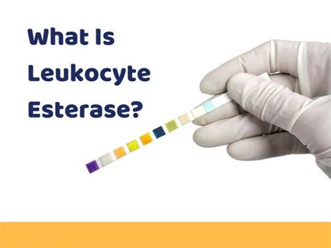 What is Leukocyte Esterase?