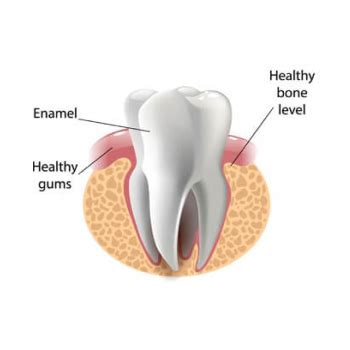 Flap Surgery | West Chester Dental Arts | 610-696-3371