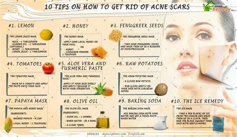 Jarts: Share How to get rid of acne scars home remedies fast