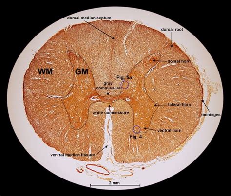 spinal cord cross section | Removal tool, Anatomy and physiology ...