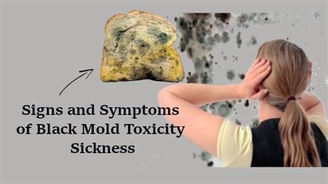 11 Signs and Symptoms of Black Mold Toxicity Sickness in Humans