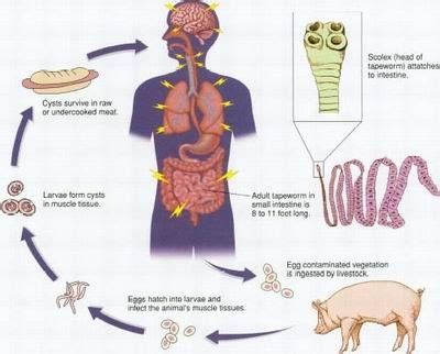 Tapeworm Infection Causes, Symptoms, Diagnosis and Treatment | Natural ...