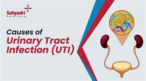 UTI Symptoms & Causes: Expert Insights for Relief