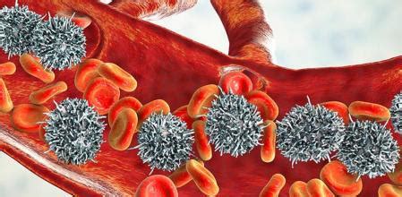 ¿Qué es la leucemia crónica? | Síntomas, causas y cómo tratar la enfermedad