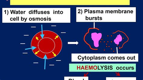 Hypertonic hypotonic isotonic simple diagrams - tronicbasta