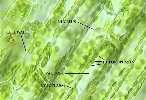 Plant Cell Under Microscope 400x