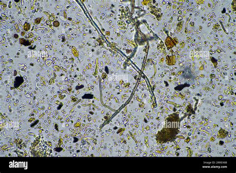 Fungal and fungi hyphae under the microscope in the soil and compost ...