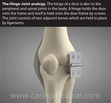 The Hinge-Joint Analogy