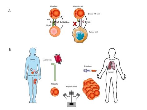 Adoptive NK cell therapy - Cimaas