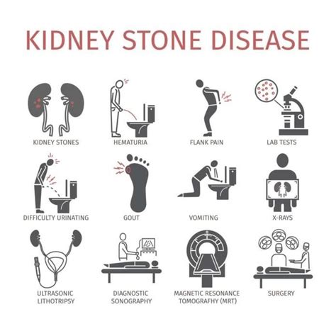 Kidney Stone Symptoms; 7 Signs and Symptoms of Kidney Stones