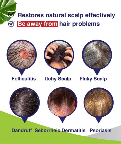 Scalp Folliculitis Treatment Shampoo