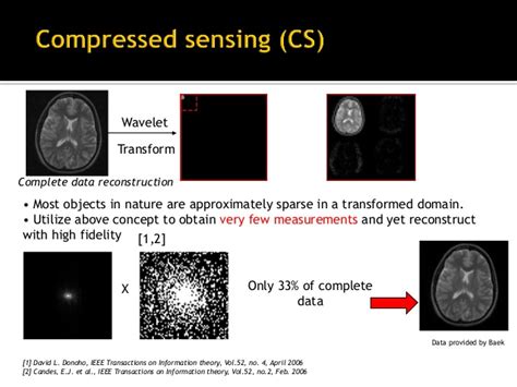 Compressed Sensing MRI — MATLAB Number ONE