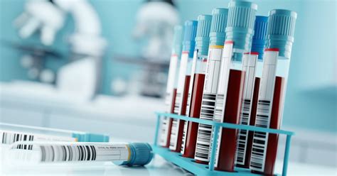 Inflammatory markers explained - ARC West