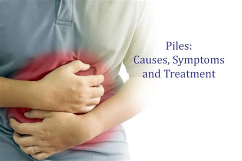 What is Piles Cause, Symptoms and Treatment – Laser piles Clinic