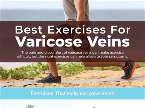 Best Exercises For Varicose Veins