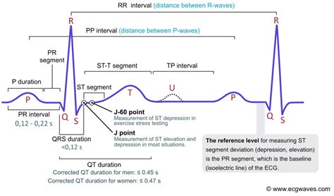 Approach To ECG Interpretation SpringerLink, 41% OFF