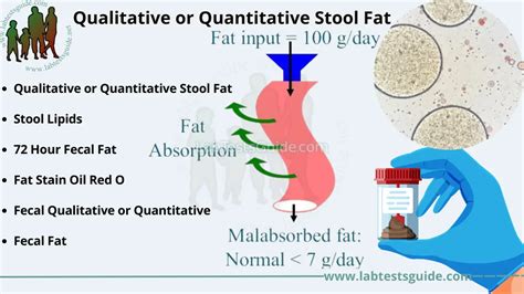 Qualitative or Quantitative Stool Fat : Purpose, Procedure, and ...