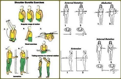 Shoulder Bursitis - Treatment, Exercises, What is, Symptoms