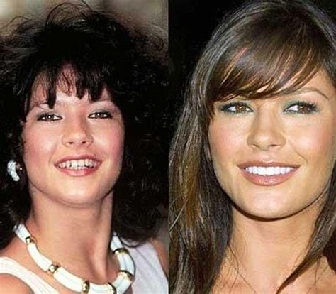 In Case You Missed: 20 Celebrities With Fake Teeth