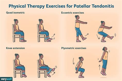 Exercises for Patellar Tendonitis