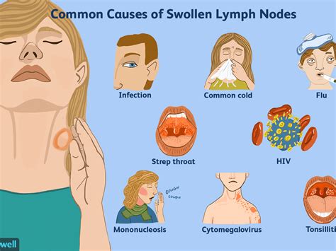 Swollen lymph nodes in neck one side - palfiln