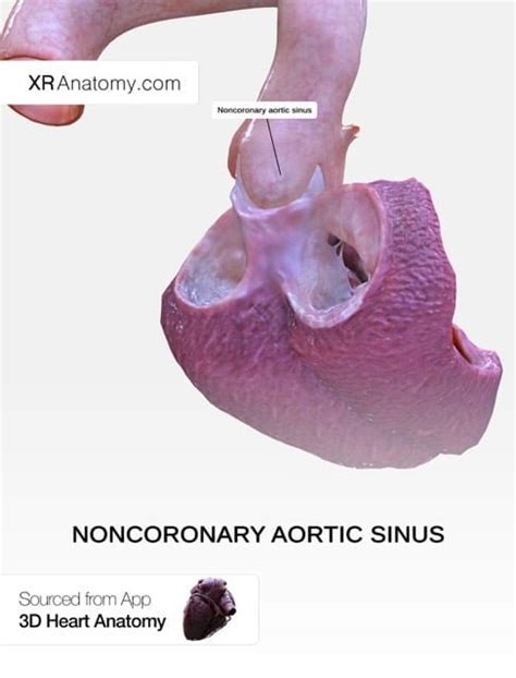 Aortic Valve - XR Anatomy