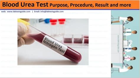 Blood Urea Test Purpose, Procedure, Results and more | Lab Tests Guide