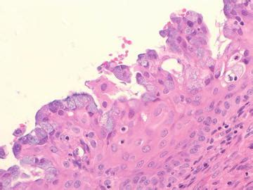 Normal Histology and Cytology of the Endocervix and Endometrium | Obgyn Key