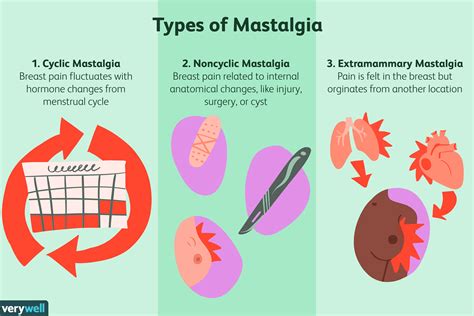 Mastalgia: Symptoms, Causes, Diagnosis, and Treatment