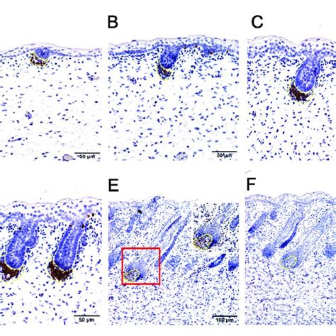 Structural comparisons between mouse and human skin. Histology of the ...